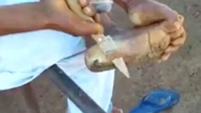 best way to peel dead skin off feet