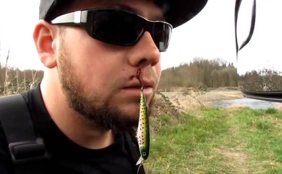 Original Video Calmly Removing A Fish Hook From The Lip RTM