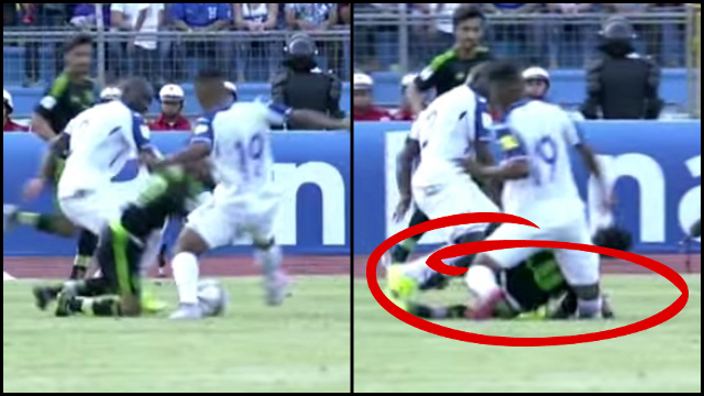 Gruesome! Soccer Player Suffers Brutal Leg Injury | RTM - RightThisMinute